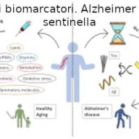 I biomarcatori plasmatici nella malattia di&nbsp;Alzheimer